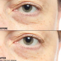 Revolution Pro Miracle Pro-Tox Instant Fix Eye Firm