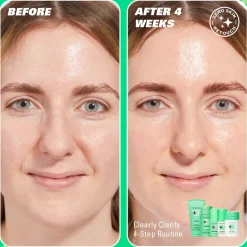 Revolution Skin Clear Canvas 5% Niacinamide & 2% Salicylic Acid Clarifying Serum 30ml