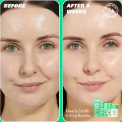 Revolution Skin Clearly Clarify 4 Step Starter Kit Minis